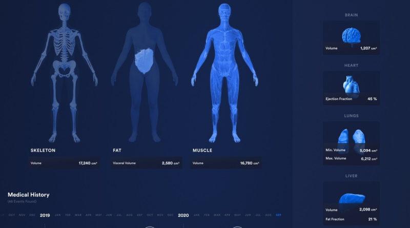 визуальная модель человека для мониторинга состояния здоровья